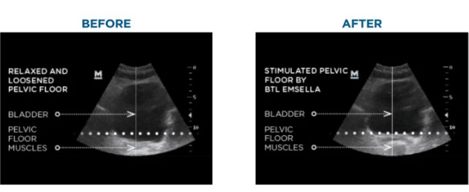1764101598_dc7af8b8ee3d4c798e0b366026bb6752 1764101598 dc7af8b8ee3d4c798e0b366026bb6752 1