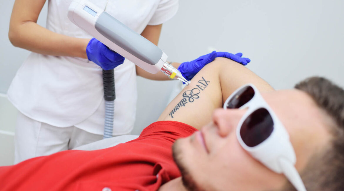 Erbium Laser Tattoo Removal