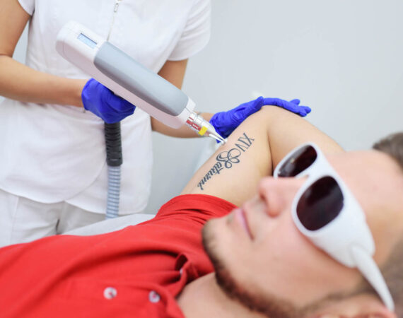 What Is There to Know About Laser Tattoo Removal?