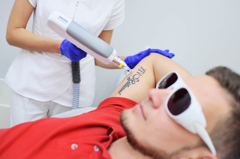 What Is There to Know About Laser Tattoo Removal?