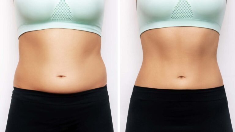 Transform with EMsculpt: Shed Weight, Gain Muscle, and Revitalize with Dr. Trinette Moss at Total Family Wellness